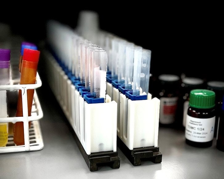 Pipetteudstyr på Filadelfias Laboratorie i Dianalund